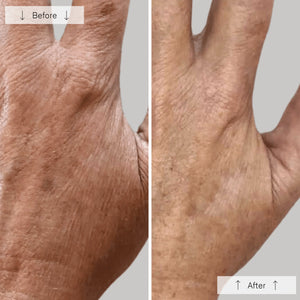 Omnilux Contour Glove ( FREE SHIPPING )